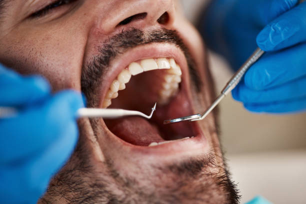 Best Emergency Dental Surgery in St Elmo, IL